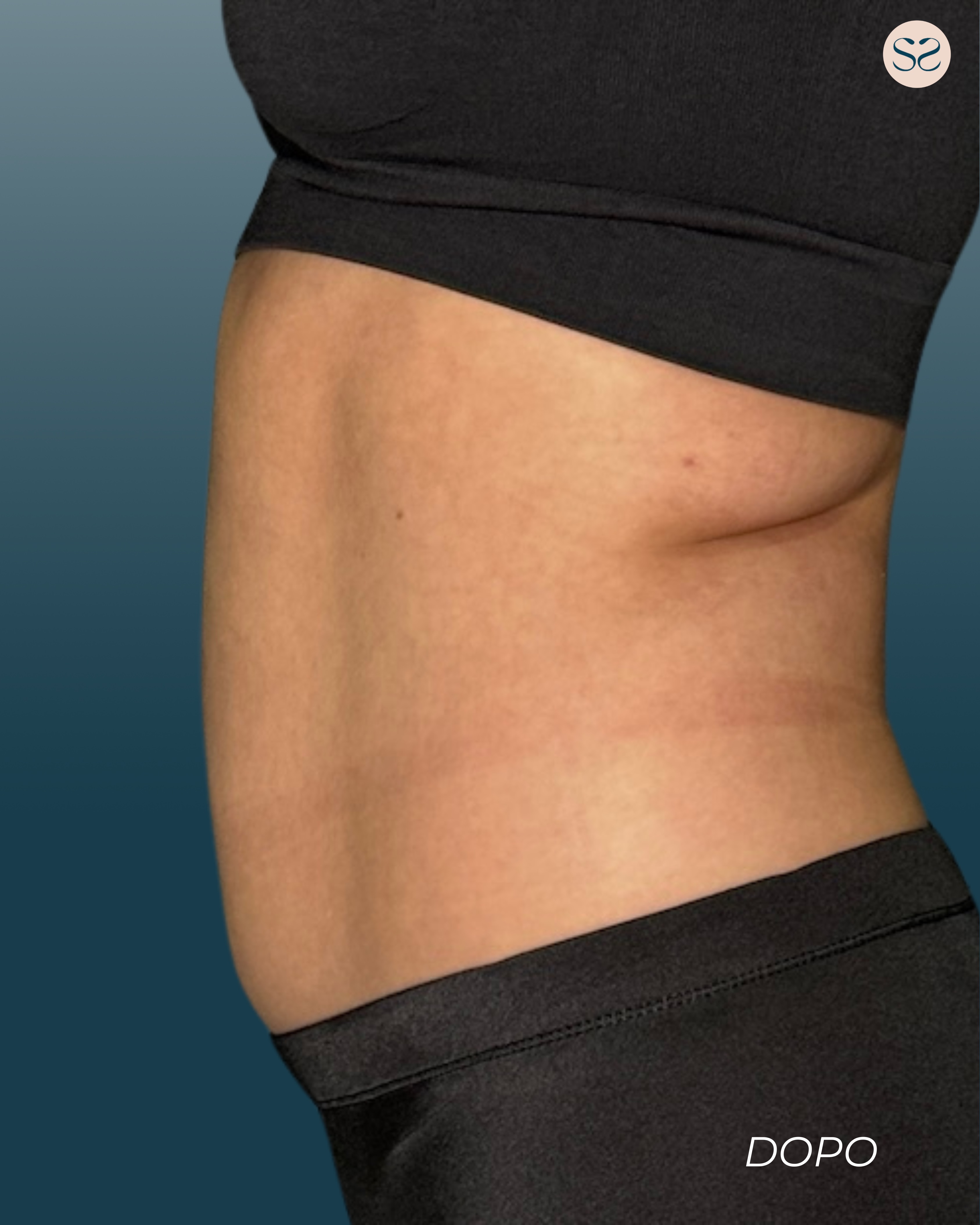 post menssana (1080 x 1350 px) - 43